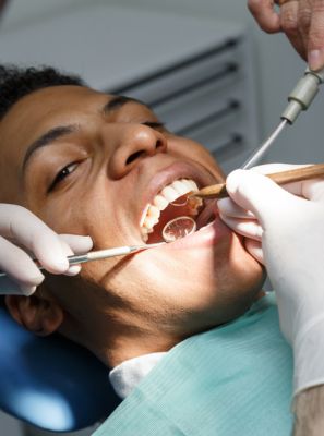 Erosão dentária: o que é, como identificar, causas e o tratamento ideal para ajudar o seu sorriso