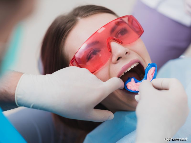 O procedimento é finalizado com uma aplicação de flúor, que ajuda a fortalecer os seus dentes, evitando a formação de cáries e outras doenças bucais.