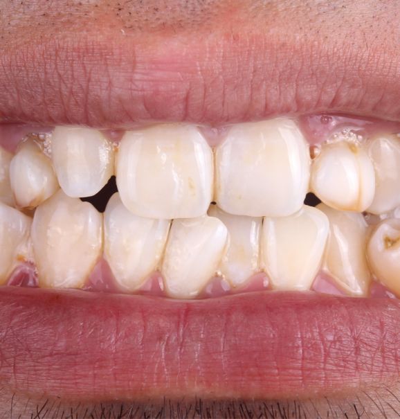 O poder da Ortodontia: confira a transformação que o aparelho ortodôntico faz pelos seus dentes