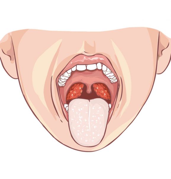 Os 5 benefícios de se escovar a língua. Você tem esse hábito?