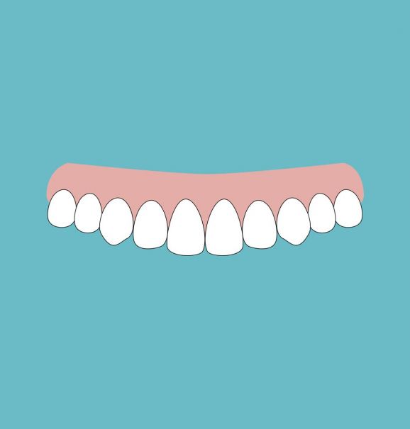Aparelho invisível: confira o antes e depois desse tratamento para quem tem dentes levemente tortos