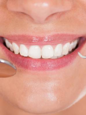 Lente de contato dental: Quanto tempo ela dura?