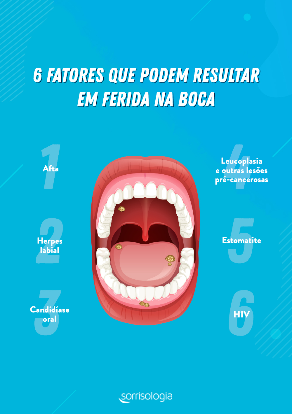 Ferida na boca: veja as principais causas para o problema bucal